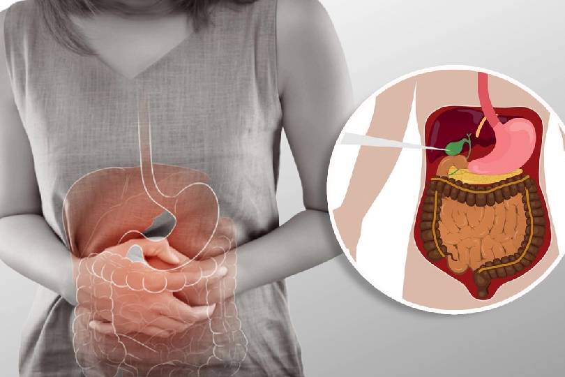 Best Bladder Stones Treatment in Baner Pune