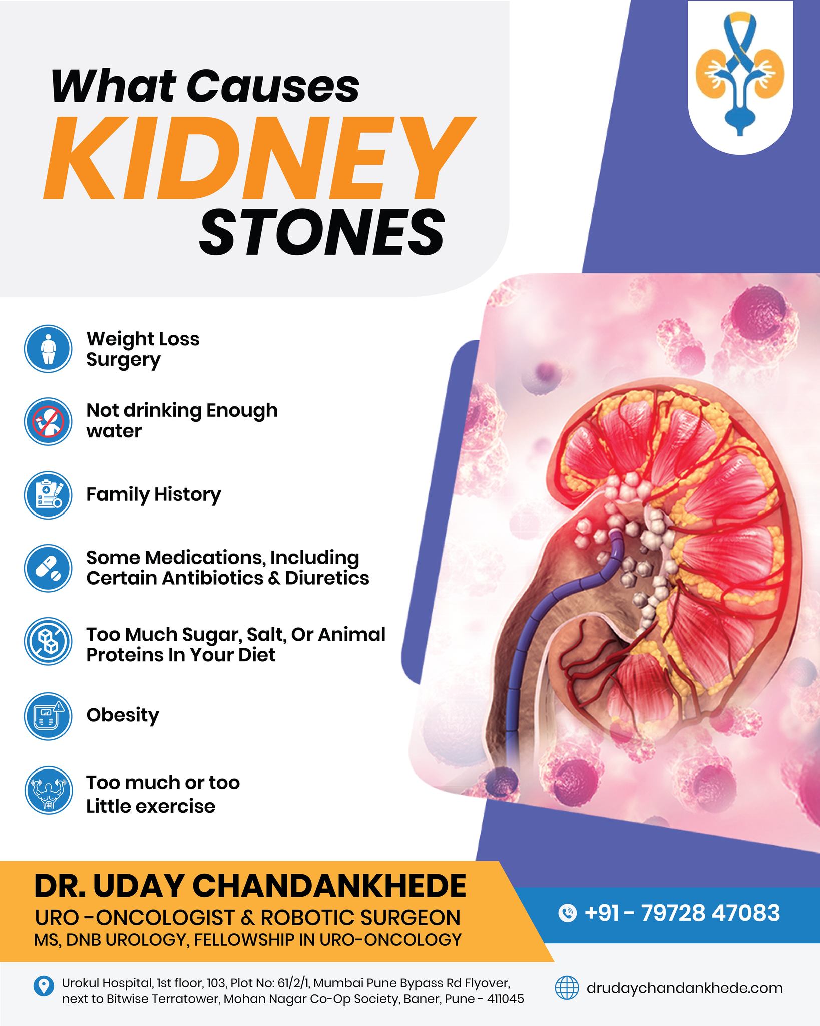 Kidney Stones Treatment in Baner